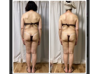 スリーピングビューティー(Sleeping Beauty)/