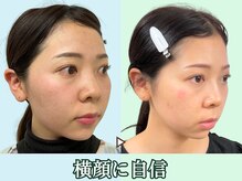 ナチュラルビューティーフェイス 横浜(NBF)/どこから見られてもＯＫ／横浜