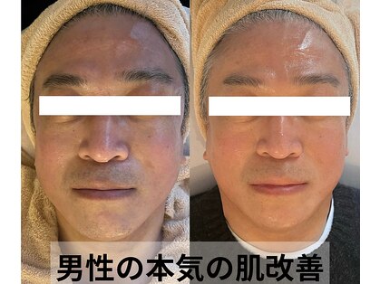 ボニータ(Bonita)の写真