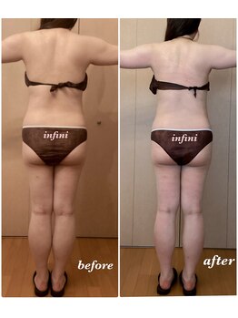 アンフィニ(infini)/短期集中コース5回目(1.5ヶ月)