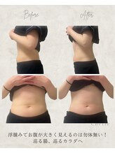 シェリー(Cherie)/内側が変われば外側も変わる