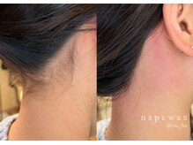 フーフラット(Huu flat)/うなじwax