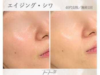 スリースリー(THREE THREE)/エイジング・しわケア