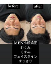 アールイー(Re:)/メンズ美容