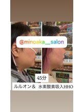 ヨサパーク ミノアカ(YOSA PARK MINOAKA)/驚きの変化ー小顔・浮腫み