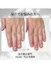 【深爪矯正/自爪育成】メニューに迷ったらまずはこちら◎
