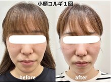 クリアーズ カグラザカ(CCLEAR'S KAGURAZAKA)の雰囲気（フェイスラインすっきり！美小顔に劇的変化するコルギも人気★）