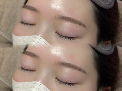 アオトスイ(aotosui)の写真