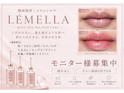 ソレラ(sorelle)の写真