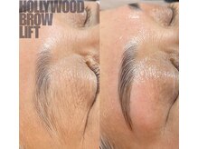 アロー(Allo!)/ HBL ハリウッドブロウリフト