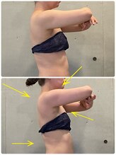 エクセレントビューティーサロン 艶(EN)/ブライダル１回