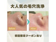 ホワイトニングジム アイスの雰囲気（毛穴スッキリ！つるん肌）