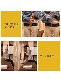 いきいき鍼灸整骨院 茨木市駅前院/一度の施術で!