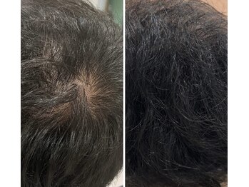 リツイート(ReTweet)/医療提携