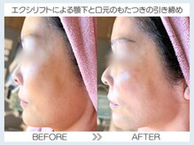 フェアリー(fairy)/