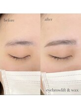 コイン(COIN)/MORI