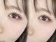 ミニョン(Mignon)の写真/【逆まつ毛・一重・奥二重の方必見】豊富なメニューとこだわりの施術で理想の目元を叶える♪モチも抜群◎