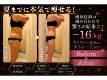 イーズ ミュゼ  ららぽーと横浜店の雰囲気（腹部はもちろん気になる部位、落ちにくい脂肪へアプローチ）