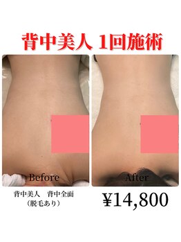 ラナ(Lana)/背中美人