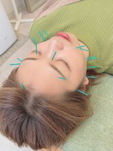 ヒーリングサロン アージュ(A-je)/★美顔鍼＋小顔矯正★