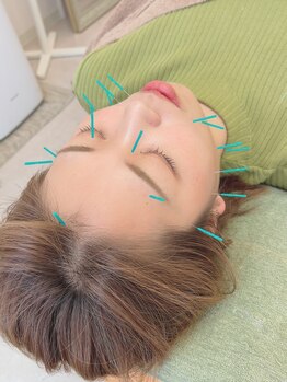 ヒーリングサロン アージュ(A-je)/★美顔鍼＋小顔矯正★