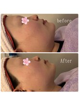 ルミナス(Luminous)/美肌＆小顔