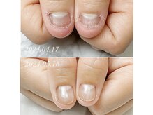 育爪対応サロン、お写真は1ヶ月での変化です♪