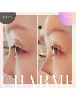 シャルム(charme)/