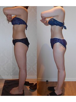 アユアランリンク 錦糸町店/D様：側面