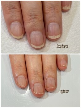 スペシャルネイルケア