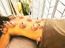 ココベルプラス(CoCo Bellepuls)の雰囲気（カッピング施術の赤みは１週間ほどで消えます）
