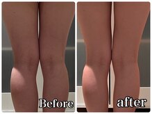 フォルチェ はません店(Folche)/脚のスキマ/ほっそり脚