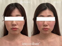 リノコロレ(ino.colore')/【小顔コルギ×脚コルギ】×1回