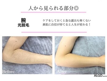 アルゴ 吹田千里山駅前店(ALGO)/【腕】