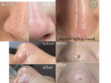 レンリー(Renry)の雰囲気（一つ一つ丁寧にオールハンドで汚れを取り除くから効果絶大！）