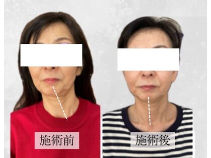 新リンパサロン 大阪の写真