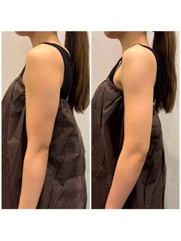 ビュウナ 銀座(BEAUNA)/ブライダル☆フェイシャル&body