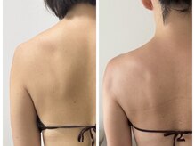 アンフェム(Anfem)/オイルリンパビフォアフ1