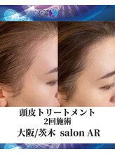 メンズサロンアール(AR)/プロセルセラピーズ