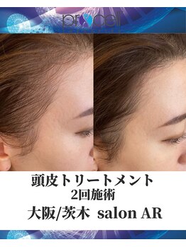 メンズサロンアール(AR)/プロセルセラピーズ