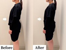 ソレア(Solea)/反り腰改善1回目