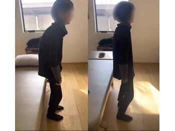 ランドル(rendre)/太ももの痛み、腰痛で歩けない。