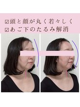 ビーホリック(Bholic)/頭と顔の伸びが短く丸く戻る