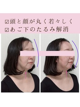 ビーホリック(Bholic)/頭と顔の伸びが短く丸く戻る