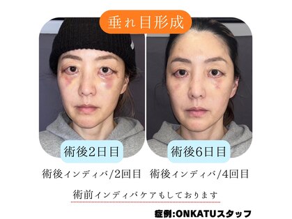 オンカツ(ONKATU)の写真