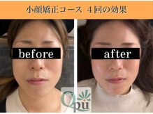キュープ 表参道店(Qpu)/続けた方しか感じられない変化♪