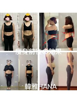 韓雅(ハナ)の写真/韓国痩身マシンを使用！結果重視で痩せたい！ボディラインを整えたい方は贅沢ケアを体験ください♪