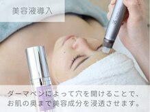 ベル 高槻店(Belle)/韓国肌管理｜エクソソーム