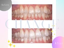 エクシアホワイトニング 碧南店