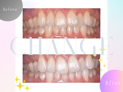 エクシアホワイトニング 碧南店の写真